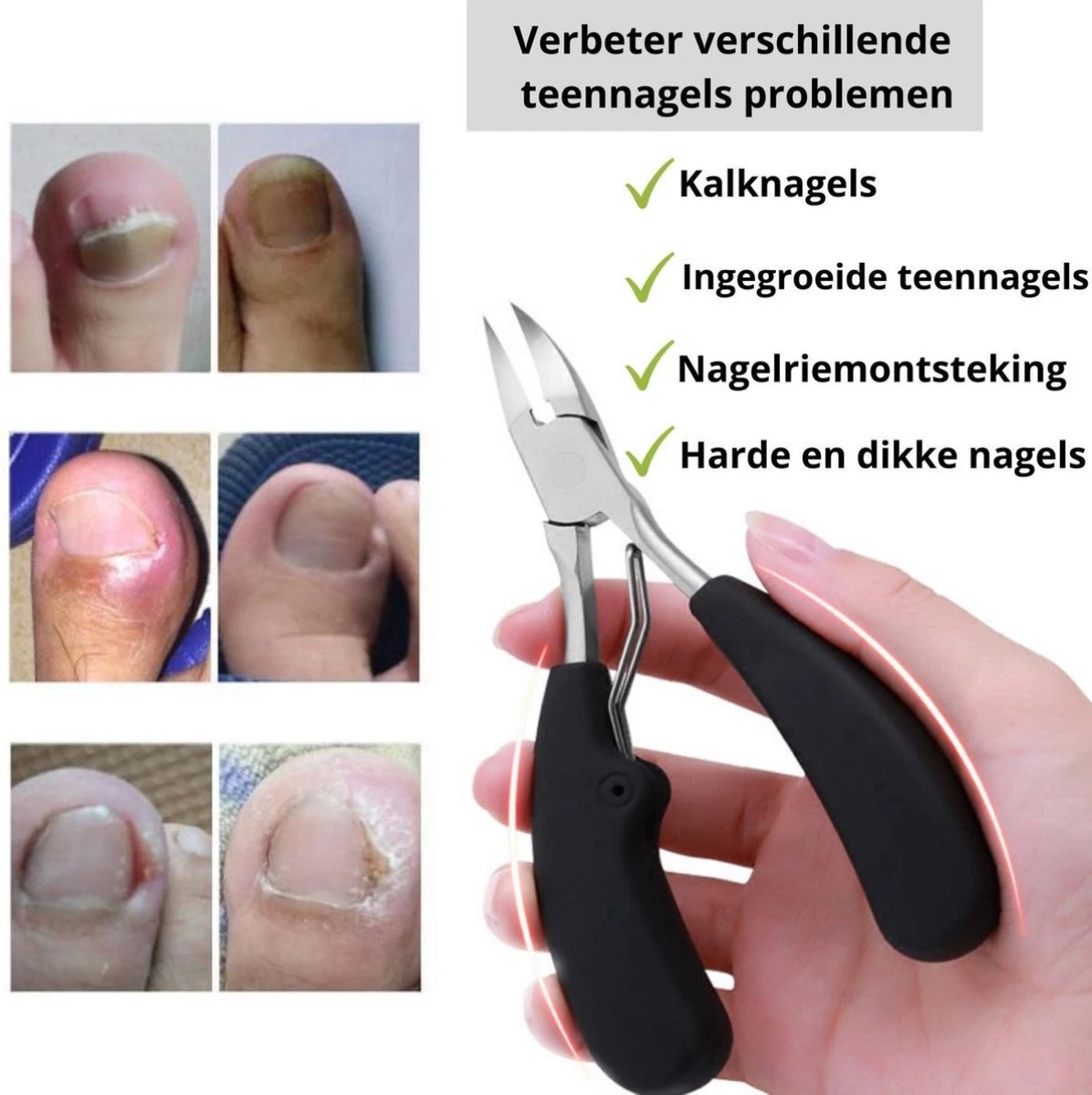 Nagelschaar Inclusief Nagelvijl - Nageltang Voor Harde Teennagels - Nagelknipper Tegen Kalknagels - Harde Nagels - Pedicureset - Manicureset Teennagelknipper - Teennagelschaar 2 Nagelschaar Inclusief Nagelvijl - Nageltang Voor Harde Teennagels - Nagelknipper Tegen Kalknagels - Harde Nagels - Pedicureset - Manicureset Teennagelknipper - Teennagelschaar - Afbeelding 2