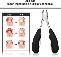 Merkloos Nageltang Met Gebogen Bek + Vijl - Nagelknipper Set - Pedicure Set 12 Merkloos Nageltang Met Gebogen Bek + Vijl - Nagelknipper Set - Pedicure Set -Poeder and Foundation Winkel 1200x1117 2