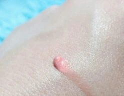 Biodermal Sun Lipbalm SPF25 - Tube 12 Ml - Natural Pink - Lippenbalsem -Poeder and Foundation Winkel 1200x927 3